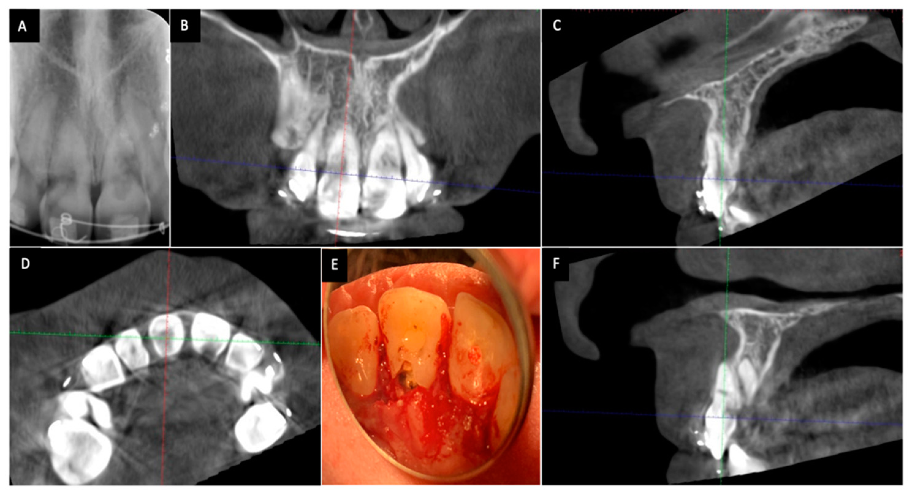 ضرورة القيام به فقط من قبل طبيب أسنان مختص